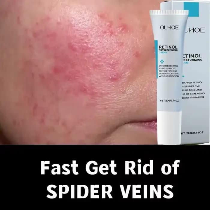Crème réparatrice pour les rougeurs du visage, améliore la sécheresse de la peau sensible, hydratant