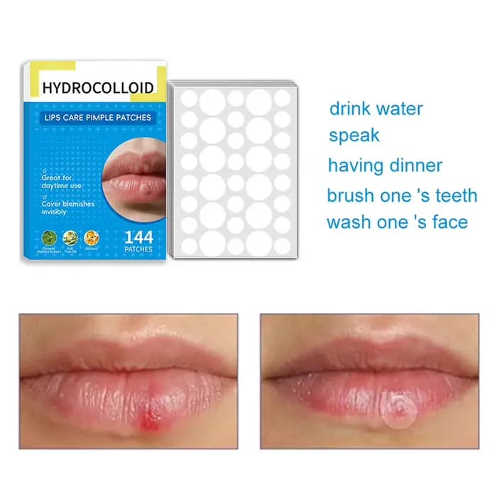 144 patchs hydrocolloïdes pour ampoules buccales et herpès labial