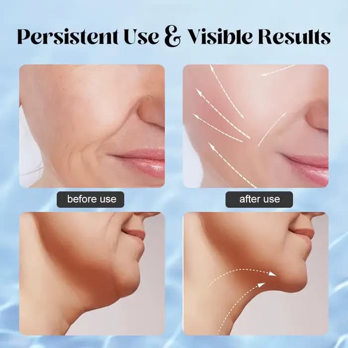 Appareil de beauté pour le lifting du visage et du cou, masseur facial EMS, thérapie par lumière LED, éliminateur de double menton, rajeunissement de la peau, resserrement, anti-rides