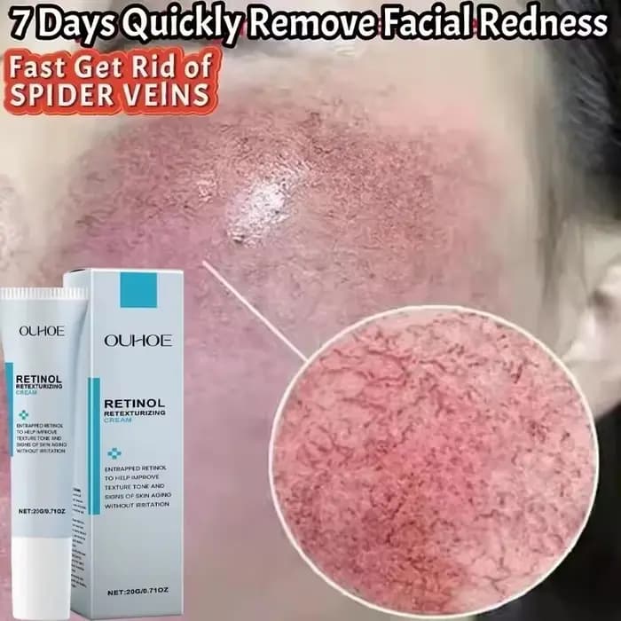Crème réparatrice pour les rougeurs du visage