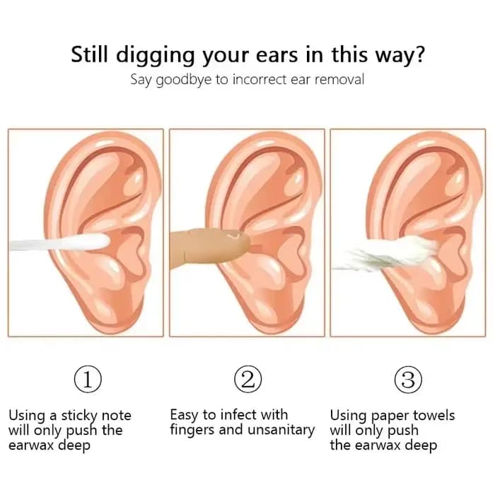 Outil efficace de nettoyage du cérumen, 6 pièces, avec cure-oreille en spirale et Curette d'oreille, outil de soins des oreilles pour un usage quotidien
