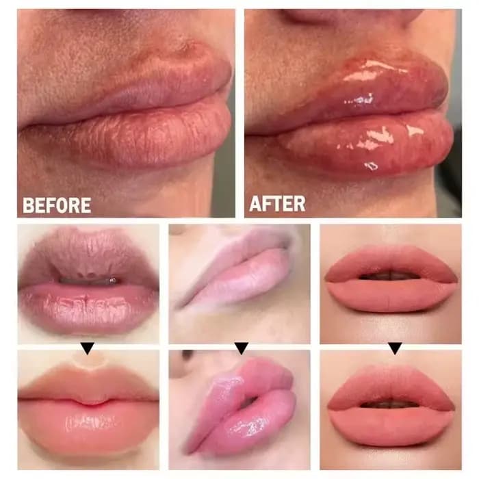 Huile Sérum Repulpante Longue Durée pour les Lèvres – Essence Volumisante Instantanée – Hydrate