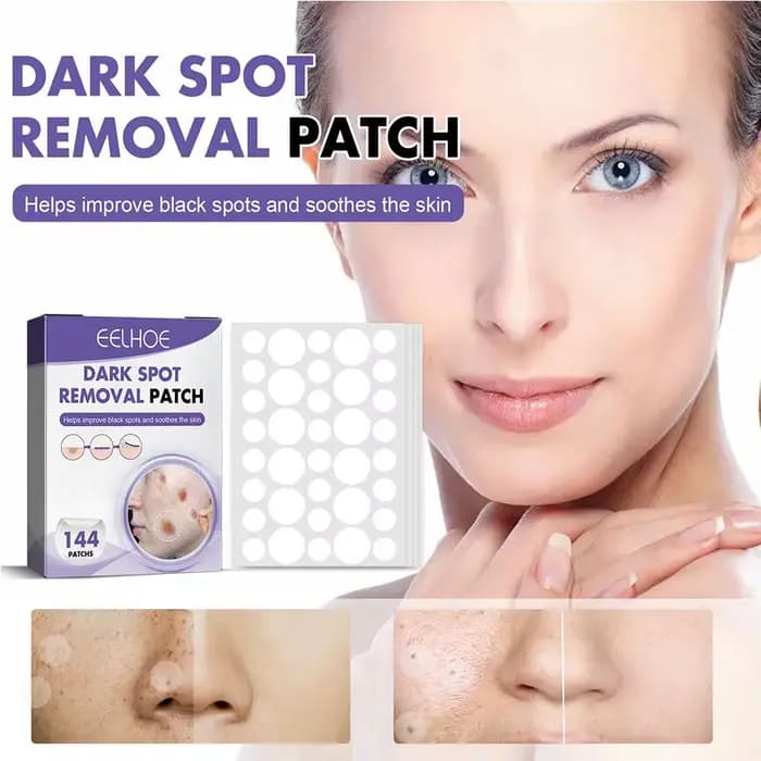 144 pièces/1 boîte Patchs pour les taches du visage