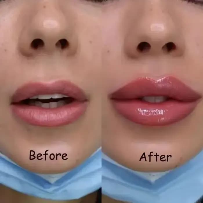 Huile Volumineuse Instantanée