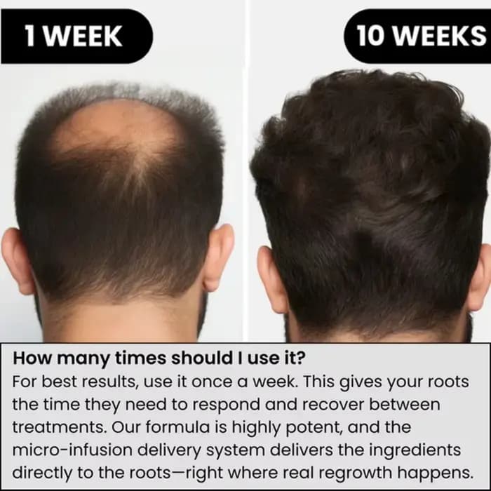 Sérum capillaire doux qui nourrit le cuir chevelu et s'occupe de l'adoucissement des cheveux, soin quotidien du cuir chevelu