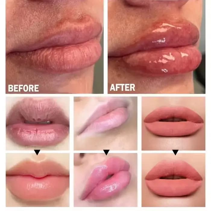 Brillant tulipe lèvres plus dodues épicule repulpant Lip Shot extrême