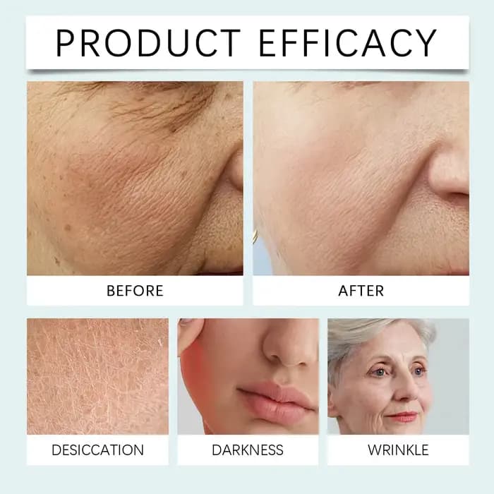 Crème raffermissante au collagène pour le visage, renouvellement, nutrition profonde, réduction des taches brunes et des taches de rousseur, éclaircissante, lissante, liftante et raffermissante